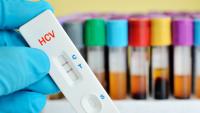 Hep C test, HCV, with samples in the background