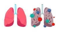 Illustration of two pairs of lungs, one surrounded by multicolored spiky viruses