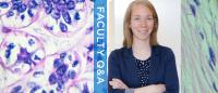 A headshot of a smiling women with arms crossed, text reading Faculty Q&A, and microscopic images of breast cancer cells